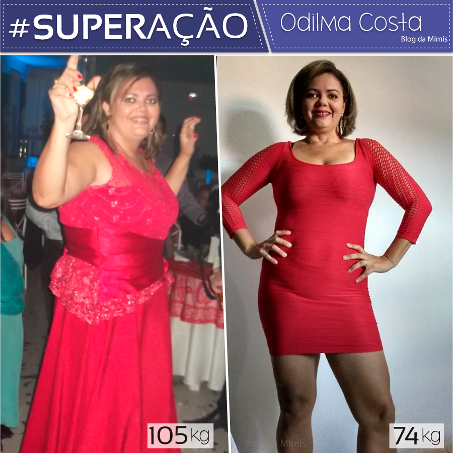 Superação-Odilma-Costa-blog-da-mimis-michelle-franzoni-01